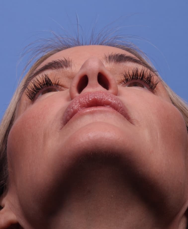 A front-facing photo taken from underneath (showing the nostrils)