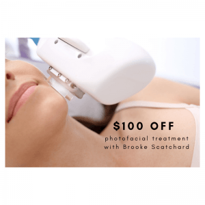 100 dollars off photofacial treatment with Brooke scatchard in Scottsdale
