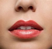Comparing Your Lip Advancement Options