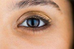 All You Need to Know About Blepharoplasty