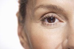 What are Dynamic Wrinkles?