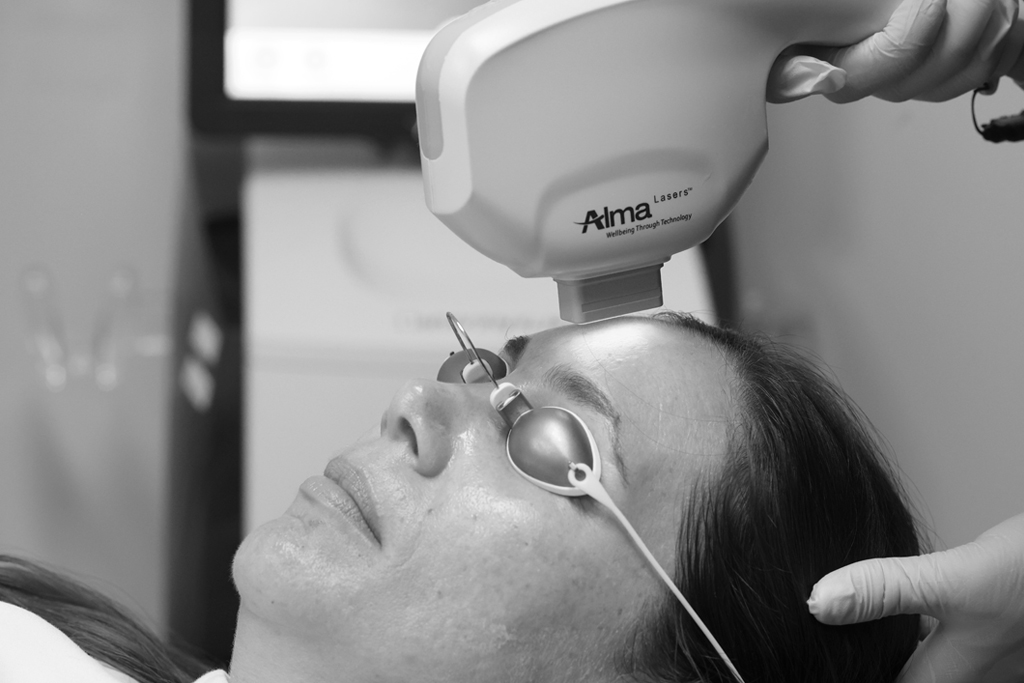 Laser Skin Resurfacing device used on patient